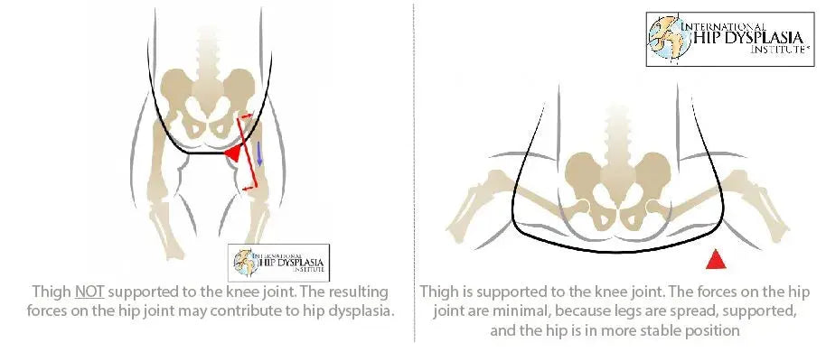 Zozinette Flexi Plus Carriers - Motherhood