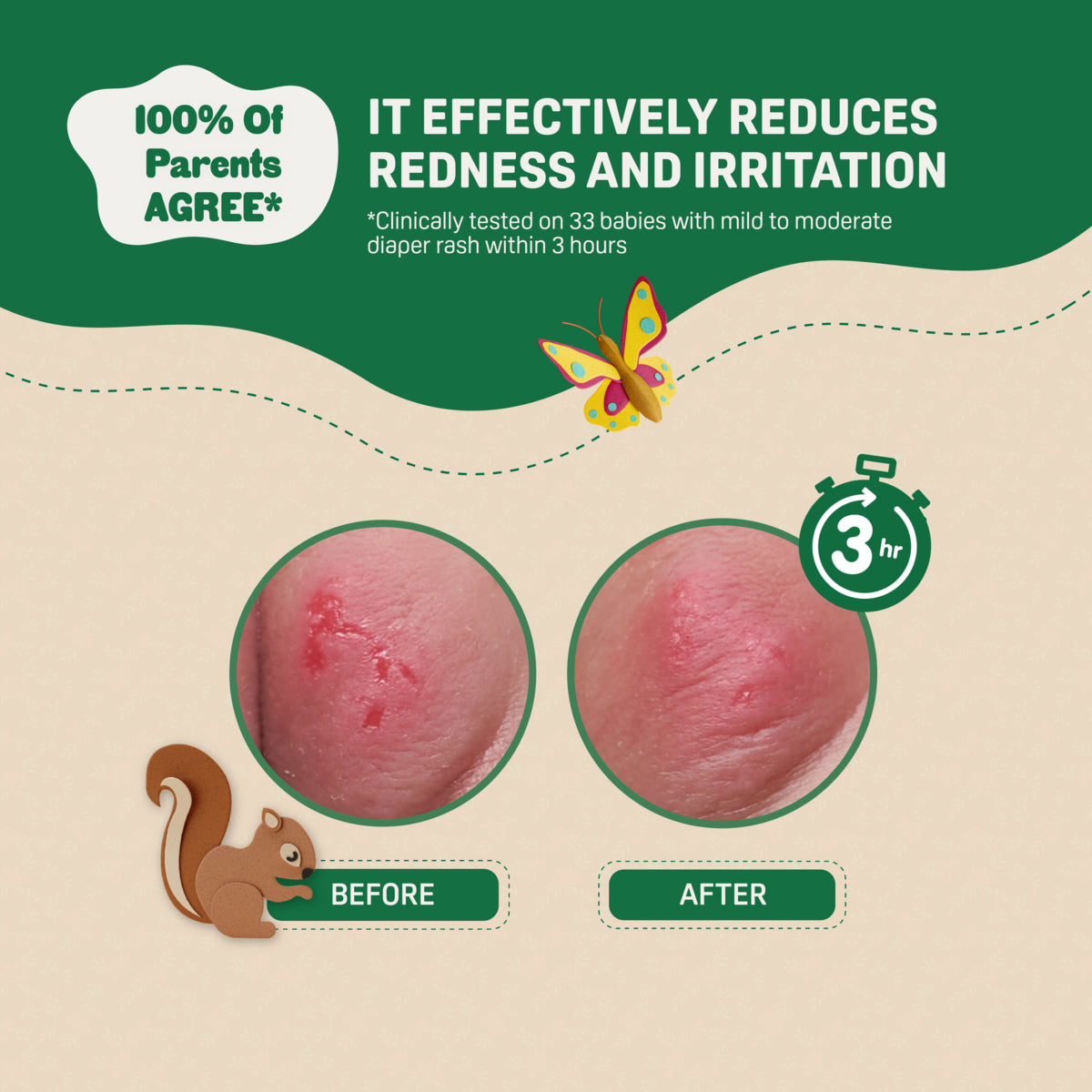 Pigeon Natural Botanical Baby Diaper Cream 50ml